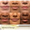Sugar Advanced Therapy Treatment lūpu balzamsSugar Advanced Therapy Treatment lūpu balzams