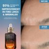 Advanced Night Repair Serum Synchronized Multi-Recovery Complex Atsauksmes