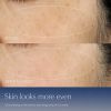 Advanced Night Repair Serum Synchronized Multi-Recovery Complex Atsauksmes