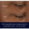 Advanced Night Repair Eye Supercharged Gel-Creme acu krēms ierobežota izlaiduma burciņā